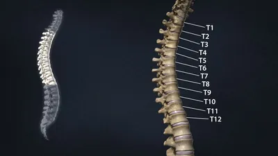 ➤ Компьютерная Томография Грудного Отдела в Киеве - Лайфскан