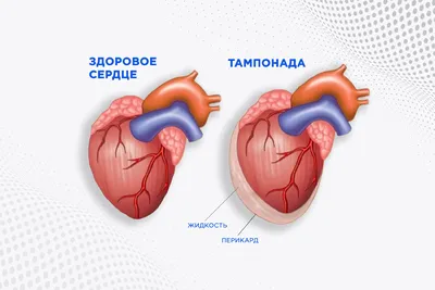 разбитое сердце обои, картинки с разбитым сердцем, сердце, любовь фон  картинки и Фото для бесплатной загрузки