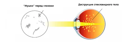 Процедуры для тела на аппарате ENDOSPHERES® AK SENSOR