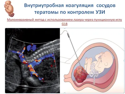 Идентичные Мальчикблизнец Акушерское Узи — стоковые фотографии и другие  картинки Беременная - Беременная, Взрослый, Внутренний орган человека -  iStock