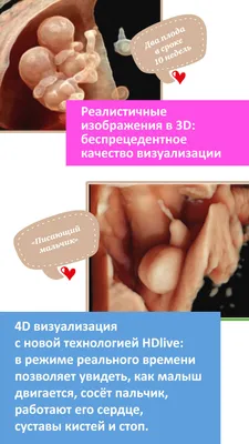 3D и 4D УЗИ плода в СПб, доступная цена - клиника УЗИ «ЛИЦ»