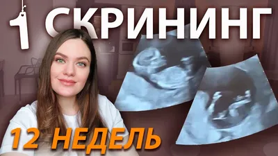 Мальчик или девочка ? Фото узи — 82 ответов | форум Babyblog