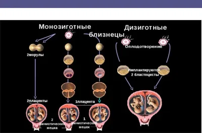 узи, фото надеюсь Гоши) 17.09.12 - УЗИ - BabyPlan