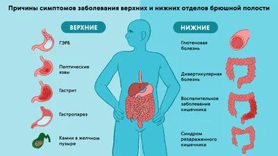 Фотогалерея \"Диастаз прямых мышц живота\" — Лечение грыжи живота, операция,  удаление грыжи в Киеве - Хирург Рейзин Денис