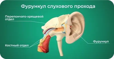 Как лечить фурункул? | Хирургия | Оздоровительный центр Шаритель в Киеве