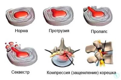 Общее хирургическое отделение в Кирове – прием и консультация в центре  здоровья Лайт