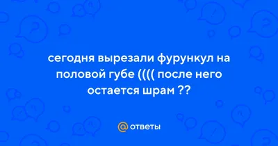 ЭНДОМЕТРИОЗ симптомы и лечение | Клиника лечения эндометриоза