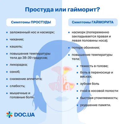 Лечение гайморита, насморка (ринита), синусита, фронтита, склеромы в  Звенигороде, цены, запись на приём