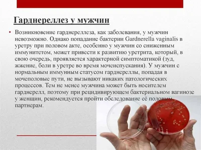 ГАРДНЕРЕЛЛА | Эпонимы и Мы | Дзен