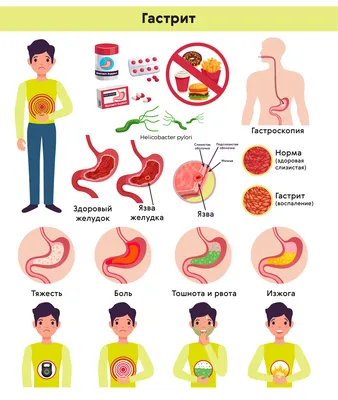 Гастрит желудка у взрослых: симптомы, проявление, лечение, признаки