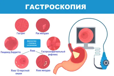 А вы уверены, что у вас хронический гастрит? — Медицинский центр Integro  Черкассы