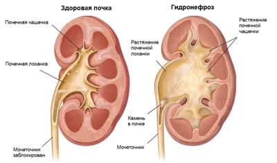 Как болят почки? / Клиники Ташкента, Медицинские Центры, Адреса и Телефоны