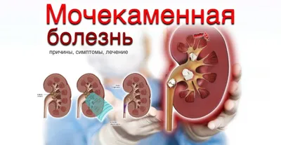 здоровье #медицина #доктор_савкина #почки #болятпочки #почкизаболели ... |  TikTok