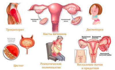 Spitalul Polivalent Novamed - Бюллетень здоровья специалистов Novamed:  Лилиана Фуйор, врач ультразвуковой диагностики - «У меня болят яичники» В  повседневной практике, как врач ультразвуковой диагностики, я сталкиваюсь  со случаями, когда женщина приходит