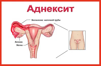 Киста половой губы: причины, симптомы, диагностика, лечение, операция в  клинике «АльтраВита»