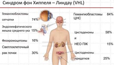 Еламед Аппарат магнитотерапии медицинский прибор Маг 30