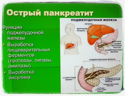 Поджелудочная железа — как понять, что не так: как болит при воспалении,  симптомы заболевания у женщин и мужчин