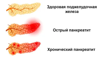 Поджелудочная железа - Kenhub