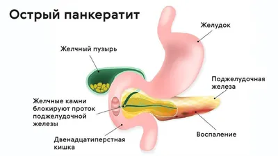 Пищеварительное ферментное средство Микразим 10000 - «Идеально помогает,  когда болит поджелудочная» | отзывы