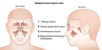 Гайморит: признаки, симптомы, лечение - МедКом