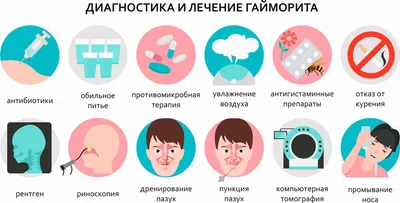 Что такое гайморит? Причины появления, симптомы и лечение