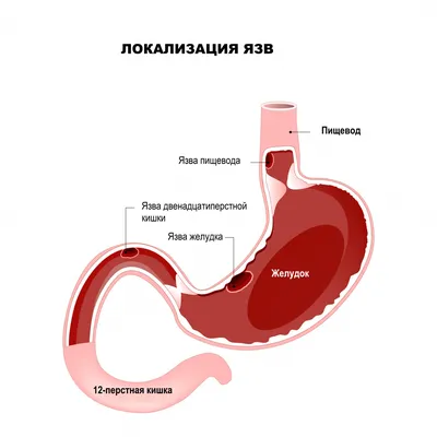 Где болит желудок при гастрите? #гастрит #желудок #боль #мишанябычков |  TikTok