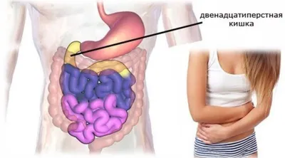 Как снять боль при гастрите или язве?