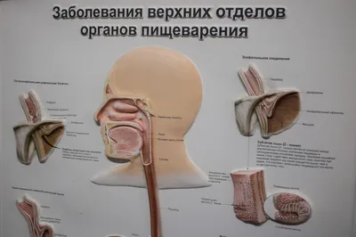 Гастрит эрозивный: симптомы, диагностика и лечение в клинике Universum  Clinic