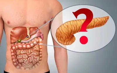Панкреатит: причины, симптомы, признаки и диагностика панкреатита у мужчин  и женщин