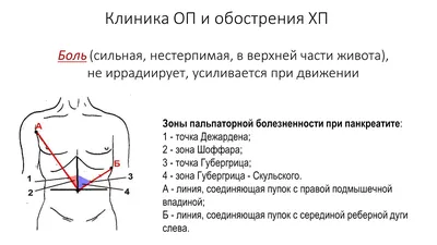 Панкреатит: симптомы, причины, диагноз и лечение