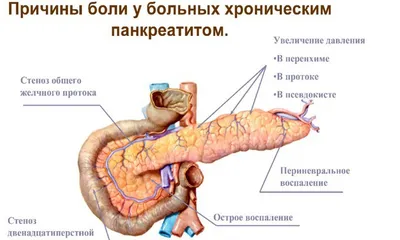 Панкреатит