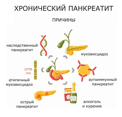 Панкреатит - симптомы и лечение у взрослых, цена в СПб