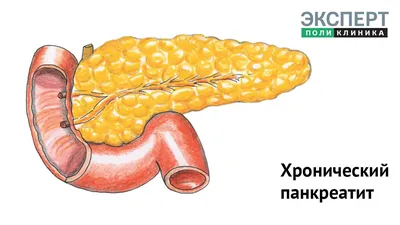 БОЛЬ ПРИ ПАНКРЕАТИТЕ - ГАСТРОЭНТЕРОЛОГИЯ | Добро пожаловать в «Клинику  Айгерим»