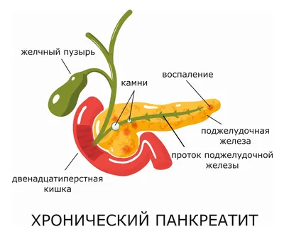 Что делать, если болит поясница? | Блог о здоровье