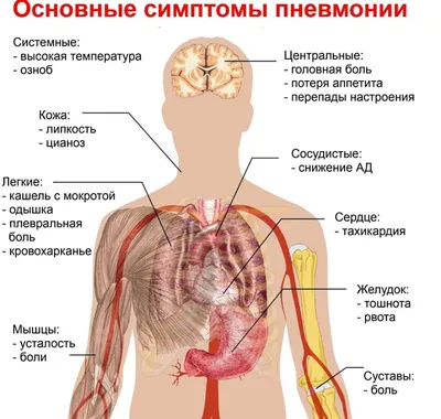 Воспаление лёгких: симптомы, лечение пневмонии у взрослых | Здоровье вашего  организма | Дзен