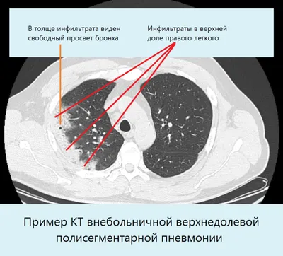 Боль в груди – к кому идти? Причины, классификация и советы врача