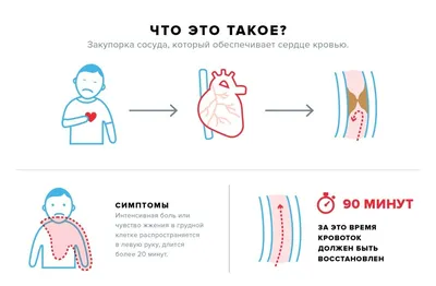 Боль в области сердца: симптомы, признаки, как понять, виды боли в сердце