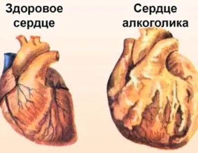 Боль в области сердца: симптомы, признаки, как понять, виды боли в сердце