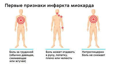 ТЕРПЕТЬ СЕРДЕЧНУЮ БОЛЬ - ОПАСНО ДЛЯ ЖИЗНИ