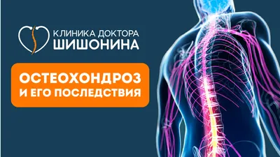 Почему возникает боль в спине в области лопаток: причины боли под левой и  правой лопаткой