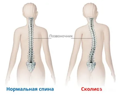 Боль в спине ❗️: симптомы, причины и лечение поясничной боли