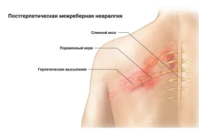 Меланома кожи: как выглядит, симптомы, причины, диагностика, лечение