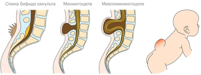 Позвоночник схемы : нормальная анатомия | e-Anatomy