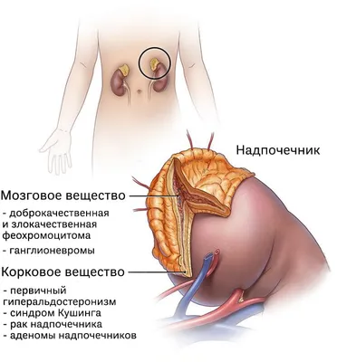 Почему болит правый бок: отвечают врачи, причины и лечение