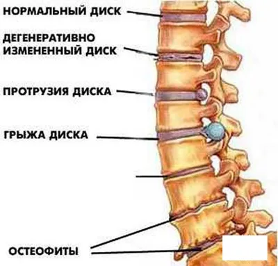 12 симптомов болезней почек, которые нельзя игнорировать - Лайфхакер