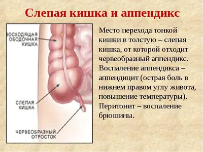 Операция аппендицита (лапароскопическая аппендэктомия) - удаление  аппендицита в Украине