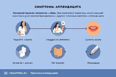 С какой стороны находится аппендицит, его симптомы у детей и взрослых