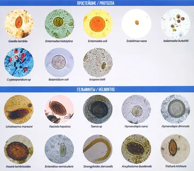 Комплекс “Гельминты и простейшие”