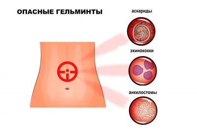 Гельминтоз - причины появления, симптомы заболевания, диагностика и способы  лечения