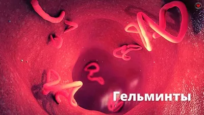 Гельминты способствуют различным заболеваниям, снижая иммунитет. Травим  глистов. | ЗДОРОВЬЕ И ТОЧКА | Дзен